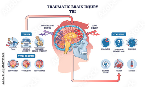 Traumatic brain injury is shown with a side-view head, brain impact zones, and labeled symptoms and causes, transparent background.