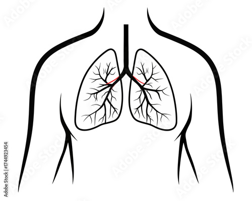 Illustration of human torso with lungs and bronchial tree in black and red on white background | editable eps vectors silhouette