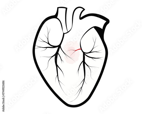 Illustration of a human heart with arteries and veins and a small red area indicating a problem area | editable eps vectors silhouette