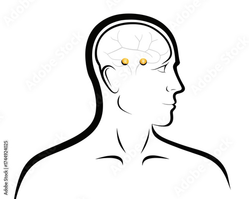 Line drawing of a head and shoulders with a brain visible and two gold dots in the brain indicating areas | editable eps vectors silhouette