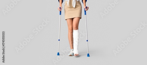 Young woman with broken leg...