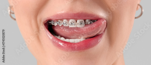 Young woman with dental bra...
