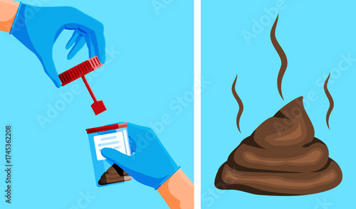 Hand with medical glove holding a stool sample container with a fresh feces pile emitting an odor. Illustration of medical fecal examination for diagnostics.