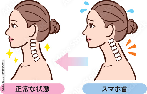 スマホ首から正常な状態への変化イラスト（女性横顔）