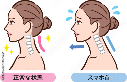正しい姿勢とスマホ首の比較イラスト（女性横顔）