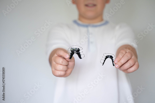 Slika na platnu Smiling child showing two removable orthodontic retainers in hands