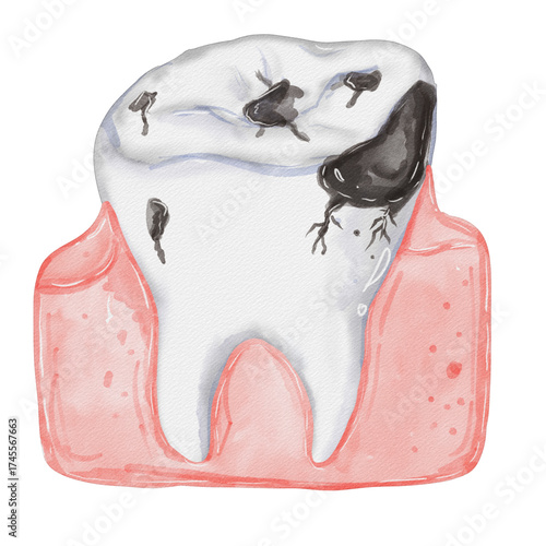 Watercolor decay teeth⁠
