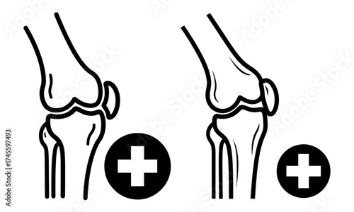 Illustration of knee joint with positive sign, representing orthopedic health and medical care