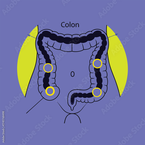 Scalable vector illustration of human colon anatomy for medical and educational purposes vector