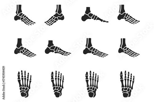 Human foot anatomy set displaying skeletal views from multiple perspectives