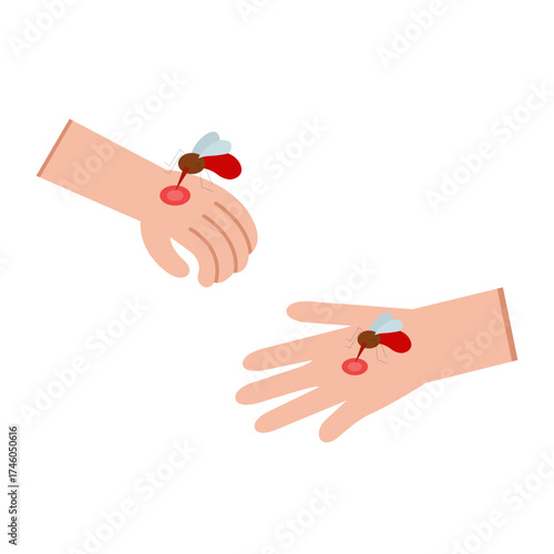 Set Flat Illustration Of Malaria