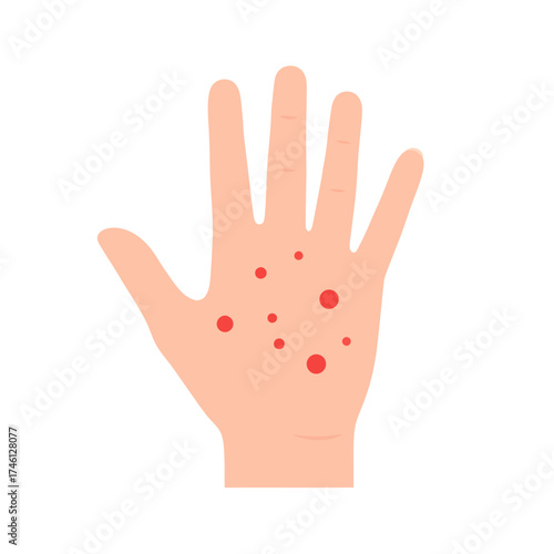 Hand with Red Spots A Sign of Potential Skin Condition.