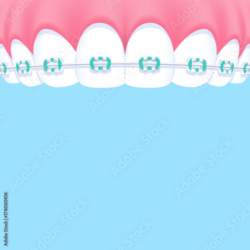 Upper teeth (Orthodontics) - Text box banner (square) illustration vector design. Dental care concept.