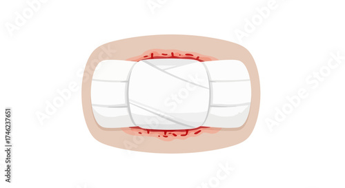 Medical Bandage Applied to a Wound.