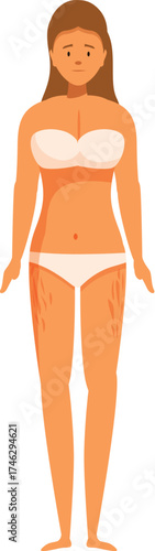 Sad woman showing stretch marks on her legs and body, concept of body positivity and self acceptance