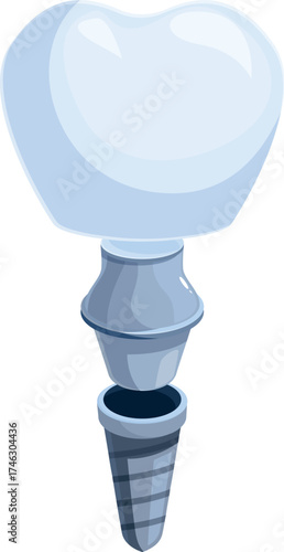 Exploded view of a dental implant showing the implant, abutment and crown