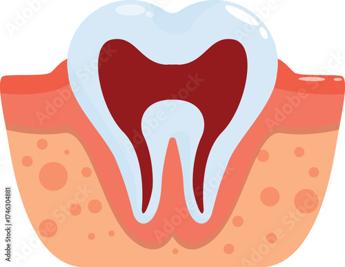 Cross section of a healthy tooth highlighting its internal structure, including enamel, dentin, pulp, cementum, and surrounding bone tissue