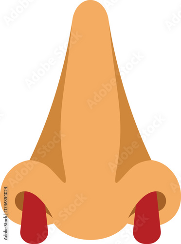 Illustration of a human nose showing nasal congestion