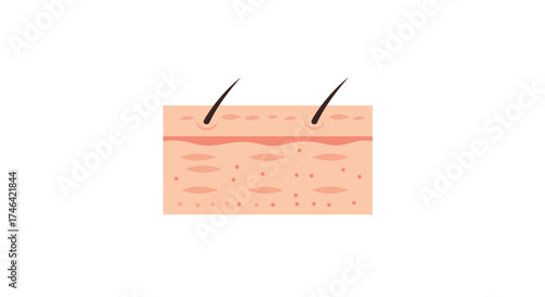 Diagram of skin layers illustration for medical or educational purposes