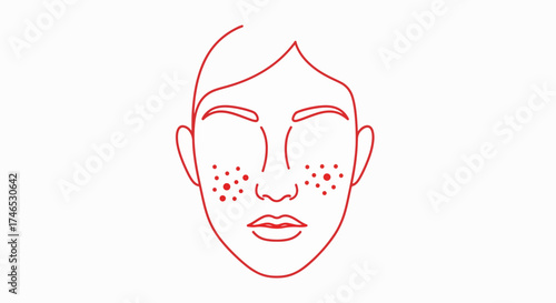 Facial outline with acne portrayed as minimalist face icon with acne in red, showcasing skin conditions. Minimalist face icon with acne highlights skin health and dermatological concerns.