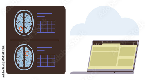 Brain MRI scans paired with a laptop and cloud graphic, representing digital medical records. Ideal for healthcare, diagnostics, neurology, cloud storage, online data, telemedicine, simple flat