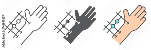 Fixation joints surgery icon, medical and equipment, hand surgery sign, vector graphics, a linear pattern on a white background. editable stroke