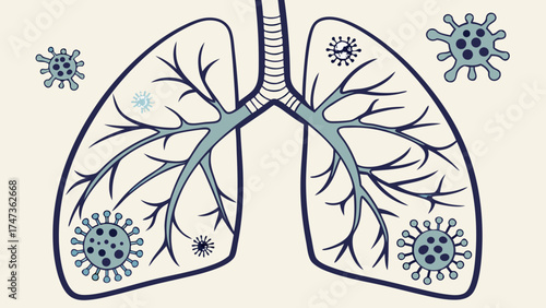 Stylized illustration of lungs with viruses medical infographic respiratory system healthcare design illness concept.