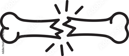 Simple line drawing of a broken bone with jagged edges