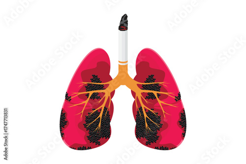 Vector illustration of human lungs damaged by cigarette smoke. Concept of smoking danger, lung disease, and health awareness.