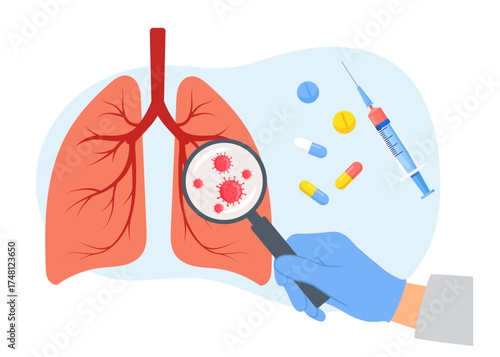 Huge human lungs affected with disease stock illustration