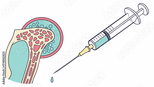 Medical injection illustration healthcare treatment syringe needle anatomical diagram bone structure cells fluid vaccination therapy medicine healthcare medical injection needle syr.