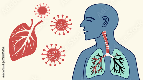 Respiratory System Virus Infection Human Anatomy Lungs Healthcare Medical Illustration Virus Microbiology Respiratory Tract Infection Illness Disease Healthcare Illustration Medical.