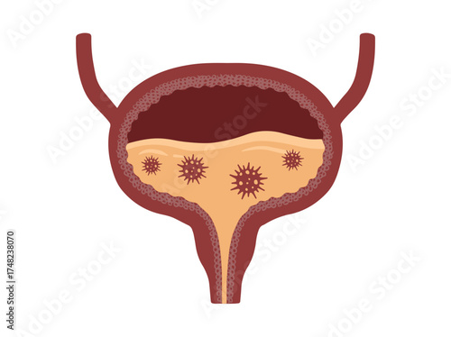 Bladder Infection Bacteria Virus