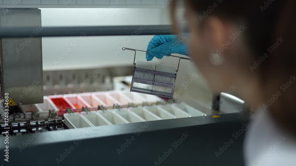 Lab Staining Tray Female scientist in blue gloves holding slide rack over staining trays ...