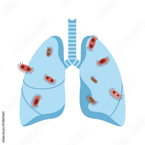 Medical illustration of human lungs infected with bacteria