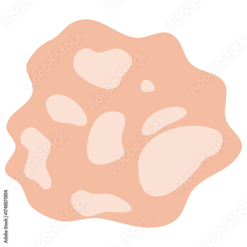 Tinea Versicolor Illustration for science education, representing cellular biology and microscopic life, perfect for educational materials or scientific diagrams, vector derived