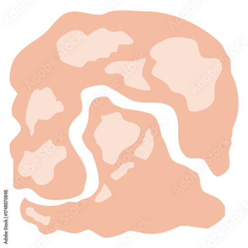 Tinea Versicolor Illustration for science education, representing cellular biology and microscopic life, perfect for educational materials or scientific diagrams, vector derived