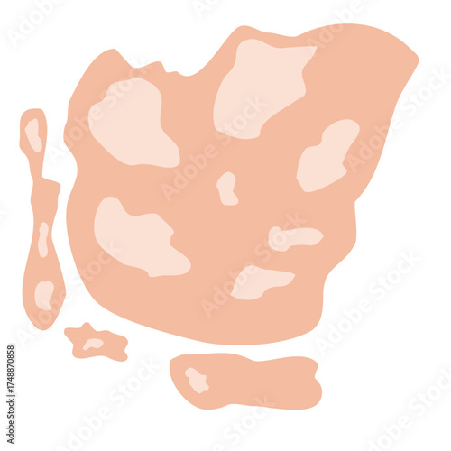 Tinea Versicolor Illustration for science education, representing cellular biology and microscopic life, perfect for educational materials or scientific diagrams, vector derived