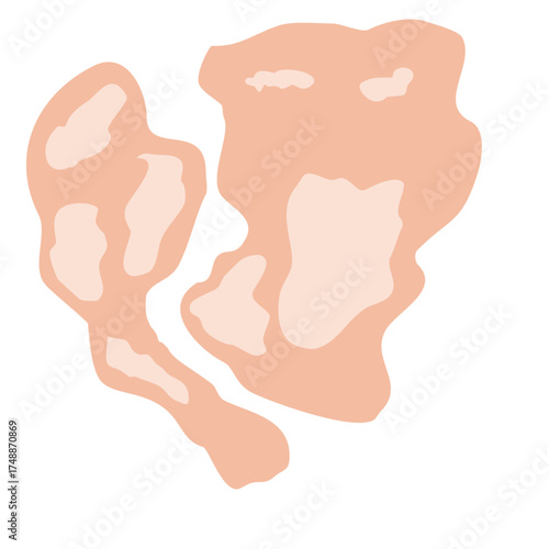 Tinea Versicolor Illustration for science education, representing cellular biology and microscopic life, perfect for educational materials or scientific diagrams, vector derived