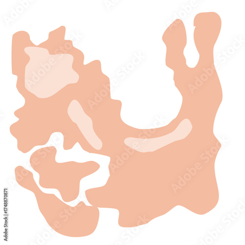 Tinea Versicolor Illustration for science education, representing cellular biology and microscopic life, perfect for educational materials or scientific diagrams, vector derived