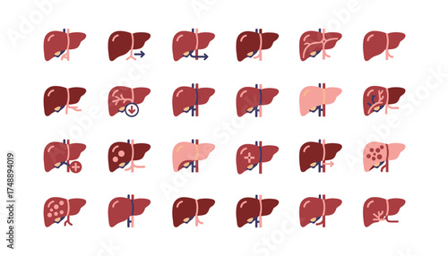 Liver disease vector icon set. Cirrhosis, hepatitis, cancer symbols. Human organ anatomy concept. Medical illustration for fatty liver, failure, transplant, health diagnosis.
