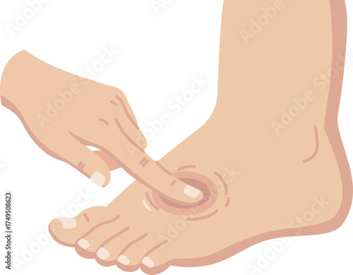 Checking edema 