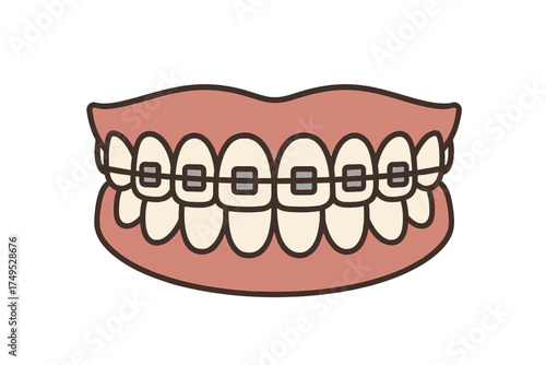 Cartoon illustration of teeth with braces