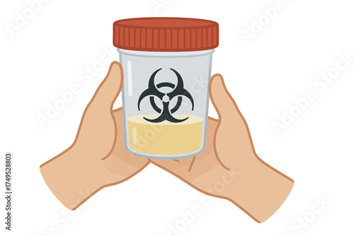Illustration of urine sample in jar with biohazard symbol held by hands