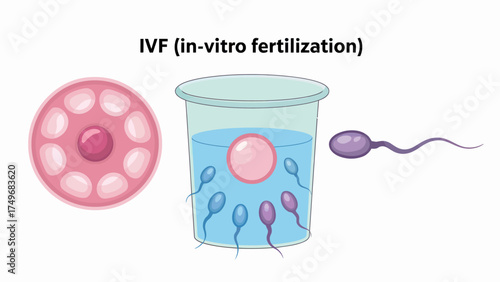 In Vitro Fertilization IVF Illustration Depicting Egg and Sperm Cells in Scientific Context