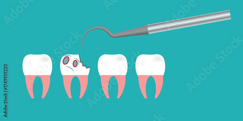 Dental Care Concept With Tooth, Damaged Tooth, And Extraction Tool On Teal Background