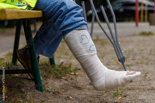 legs and crutches in the park