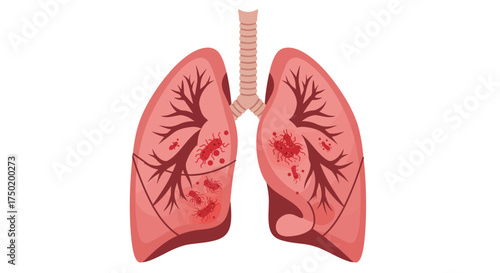 Detailed lung illustration showing viral infection or disease, perfect for medical education, awareness campaigns, and healthcare promotions focused on respiratory health