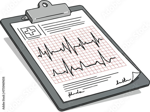 An electrocardiogram printout on a clipboard with a red grid and black squiggly lines on a white background.