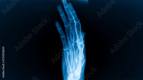 Medical X-Ray Visualization of Hand and Wrist Bones Rotating for Diagnosis